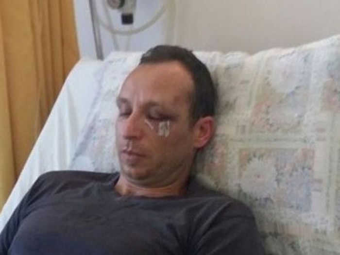 Στο Εφετείο Χανίων αναβιώνει ο ξυλοδαρμός του γιατρού Δημήτρη Μακρέα